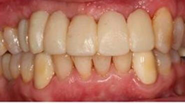 Perfect healthy smile after cosmetic dentistry