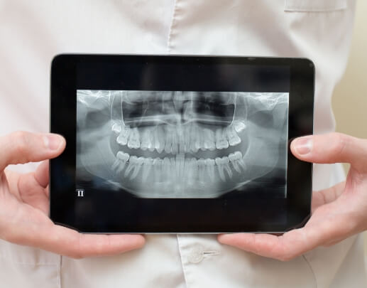 Digital x-rays on tablet computer