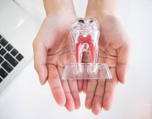 Hands holding a model tooth demonstrating root canal therapy results